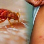 Najezda kućnih stjenica: sve češći problem i kako ga suzbiti